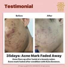 【KATA ORGANIC】Smoothing Bio-Skinfood Serum Moisturizing Anti Wrinkle Acne Mark Essence Brightening Serum 祛痘印精华｜淡化痘印｜提拉｜紧致｜补水