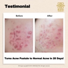【KATA ORGANIC】Tea Tree Hyaluron Emulsion Cream Anti Acne Cream Soothing Hyaluronic Acid Hydrating Sensitive 祛痘霜 保湿 痘痘 敏感肌/ 60ML